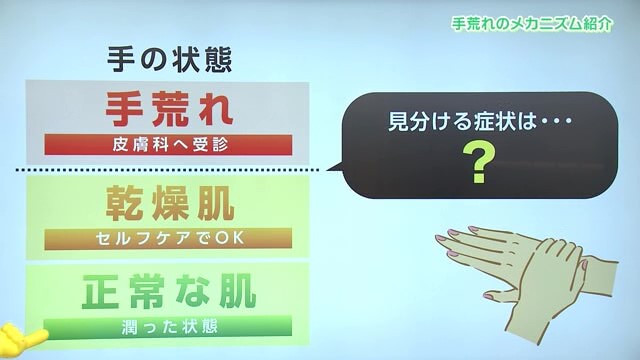 なぜ冬に手荒れが起きやすくなる？皮膚科に受診した方がいい症状とは？