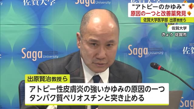 アトピー性皮膚炎の"かゆみ"原因を解明し薬を発見 佐賀大学医学部の教授らが発表【佐賀県】