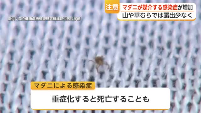 アウトドアで注意すべきマダニ感染症 県内でSFTS・日本紅斑熱感染など相次ぐ【佐賀県】